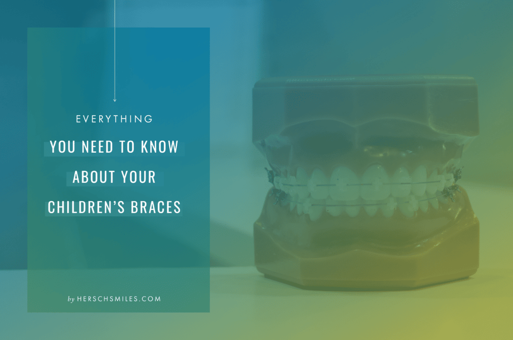 Teeth with braces model
